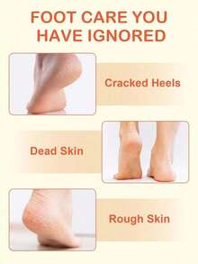 Hydrating Exfoliating Foot Mask – Treating Athlete's Foot, Softening, Moisturizing & Nourishing Dry Feet, Softens Calluses & Dry Cracked Heels Say Goodbye To Rough Feet And Enjoy Ultimate Softness! Peel-Off Foot Mask. - 60g - View 5
