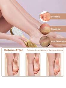 Bộ dụng cụ chăm sóc chân 4 trong 1, bao gồm bàn chải móng tay bằng gỗ, đá bọt, dụng cụ chà chân và dụng cụ loại bỏ chai sạn, phù hợp với mọi loại chân. - Nhiều màu - Xem 5