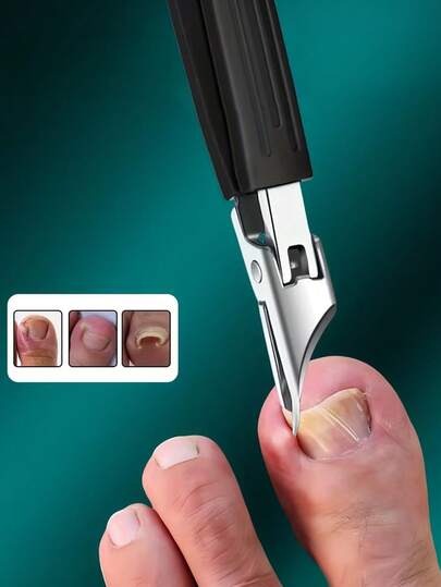 Coupe-ongles de haute précision conçus pour les ongles épais et incarnés - fabriqués en acier inoxydable durable avec une poignée à prise douce et des lames tranchantes à 25 degrés. Spécialement conçus pour les personnes âgées avec fonction anti-éclaboussures.