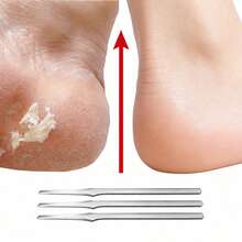 1. Dụng cụ mài gót chân bằng thép không gỉ được thiết kế đặc biệt để loại bỏ tế bào chết trên da. - A - Xem 7