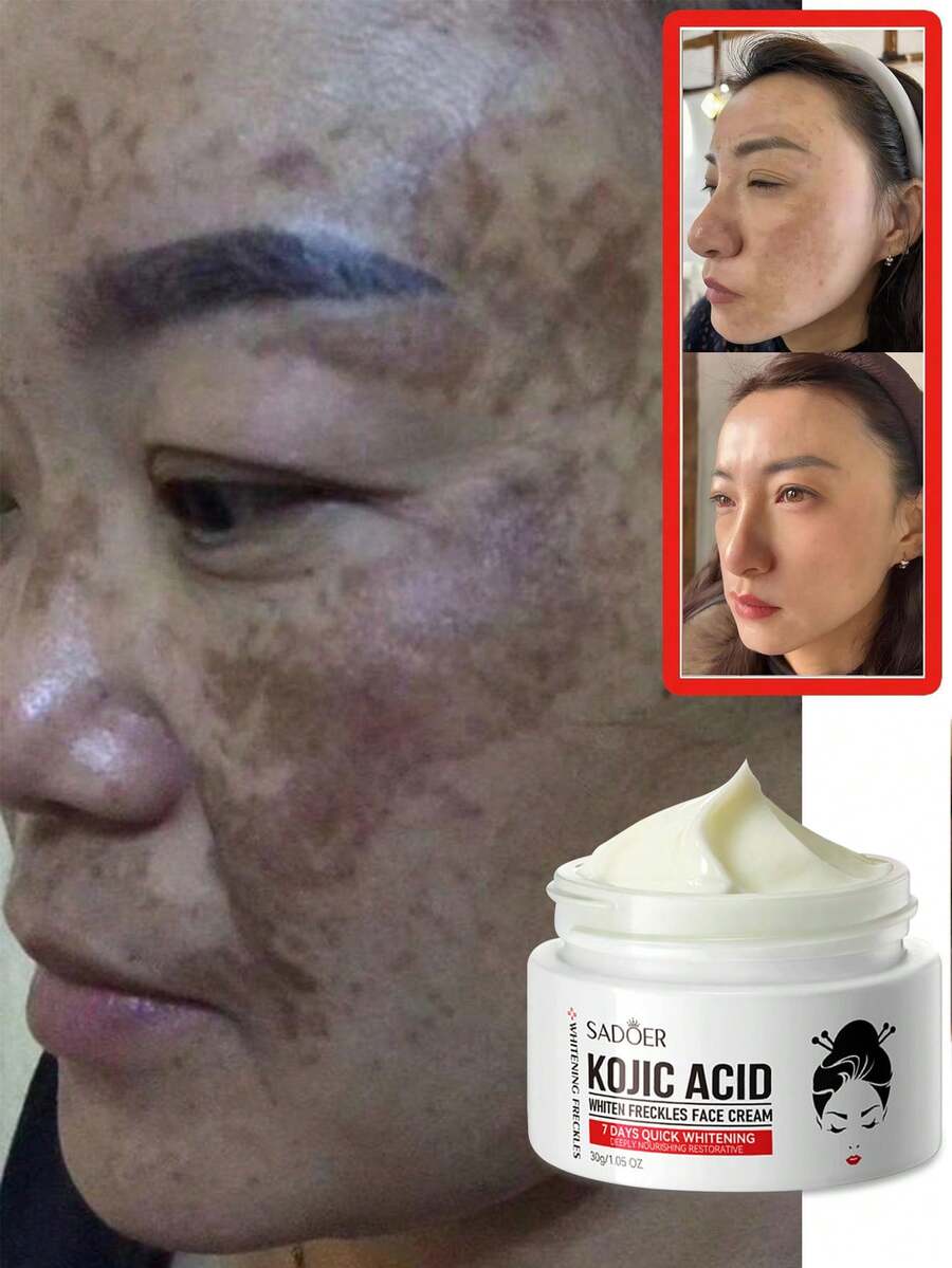 SADOER 烟酰胺亮白霜，淡化色斑，细致毛孔，适用于面部和眼部护理。温和不刺激配方，深层补水，适合所有肤质，男女皆宜的日常护肤品。