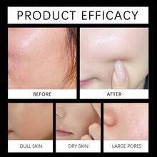 Limpiador Facial de niacinamida, limpieza suavizante, Control de aceite de suciedad, reducción de poros, ilumina la embotamiento, crema de lavado Facial hidratante - 1 - Ver 7