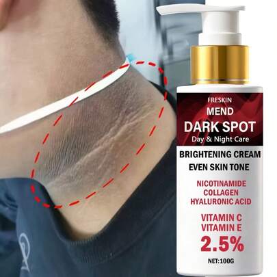 Crema blanqueadora para manchas oscuras, iluminadora, blanqueadora corporal - Para el Body, reduce la apariencia de manchas oscuras, decoloración, etc., ilumina y suaviza significativamente el tono de piel desigual. Aplicable para casos de pigmentación y propenso a manchas oscuras.