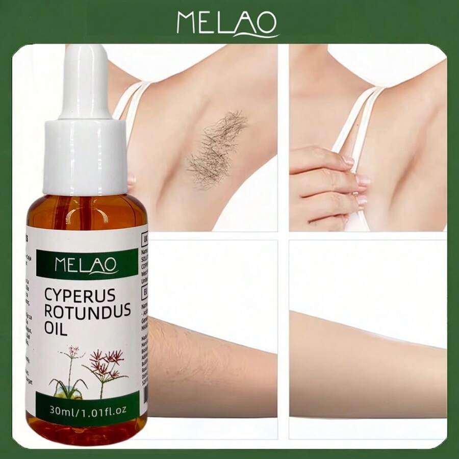 30ml/1.01 Fl Oz MELAO Aceite Natural de Citronela, Ayuda a Manejar la Apariencia del Cabello No Deseado, Fórmula a Base de Plantas - 30 ml - Ver 1