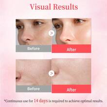 KOEC Bộ 2 sản phẩm: Thanh chống nhăn PDRN Collagen và Tinh chất dưỡng da ban ngày PDRN Pink, chứa PDRN, Collagen và Peptide, giúp dưỡng ẩm và cải thiện làn da, lý tưởng làm quà tặng Ngày của Mẹ. - Tinh chất dưỡng da PDRN + Sáp dưỡng đa năng dạng thỏi - Xem 5
