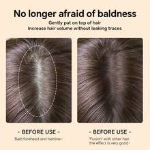 Hairline Filler, Waterproof, Sweat-Resistant, Non-Fading, Filling Powder, Shading, Contouring, High Forehead Filler - Multicolor - View 9