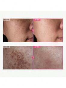 Arbutin 7% + Tranexamic Acid 4% Cream, 70,000ppm Arbutin, 40,000ppm TXA, Niacinamide, Glutathione, Dark Spots, Freckle, Blemishes, Pigmentation, Korean Skin Care, 50ml, 1.69 Fl.Oz. - 多色的 - 查看 4