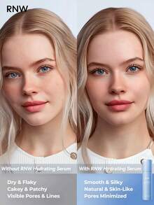 RNW Essence Lotion, Essence Texture, Fast Hydration & Moisture, Skin Brightening, Lightweight, All Skin Types, 100ml,Brand Beauty Cosmetic Makeup - Hyaluronic Acid - View 2