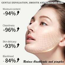 50g Exfoliating Gel - Gentle Yet Effective, Creates Smooth, Radiant Skin, Removes Dead Skin Cells, Unclogs Pores, Suitable For All Skin Types, Alcohol-Free - 粉色 - 查看 7