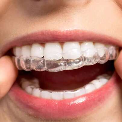 2pcs/Set Delicate Versatile Transparent Tooth Decor, Suitable For Men And Women, Exquisite Gift
