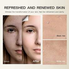 80ml/3.51oz Rice Exfoliating Ampoule - Gentle Face Exfoliator, Nourishing Skin Exfoliant For Smooth Texture And Hydration, Contains Niacinamide And Aloe - Multicolor - View 4