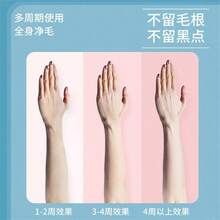 Laser Hair Removal Devices - US A Type Plug(110-127V) - View 5