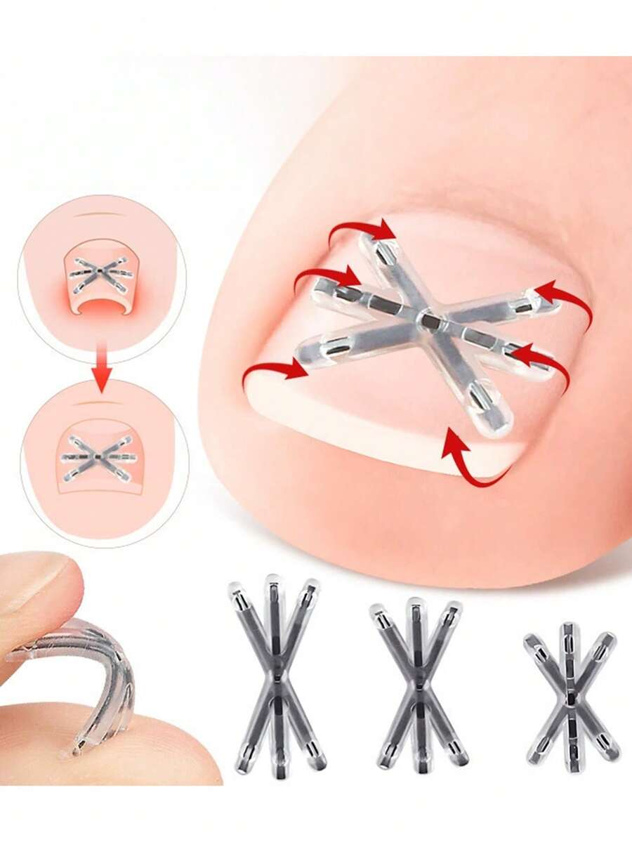 2pcs Painless Ingrown Toenail Corrector For All Types Of Foot Care - Multicolor - View 1