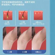 Laser Hair Removal Devices - US A Type Plug(110-127V) - View 4