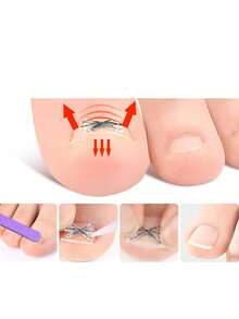 2pcs Painless Ingrown Toenail Corrector For All Types Of Foot Care - Multicolor - View 3