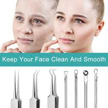 7pcs Black Head Removal Tool Kit, Suitable For Acne, Pore, Blackhead Cleaning - Multi-piece Set - View 6