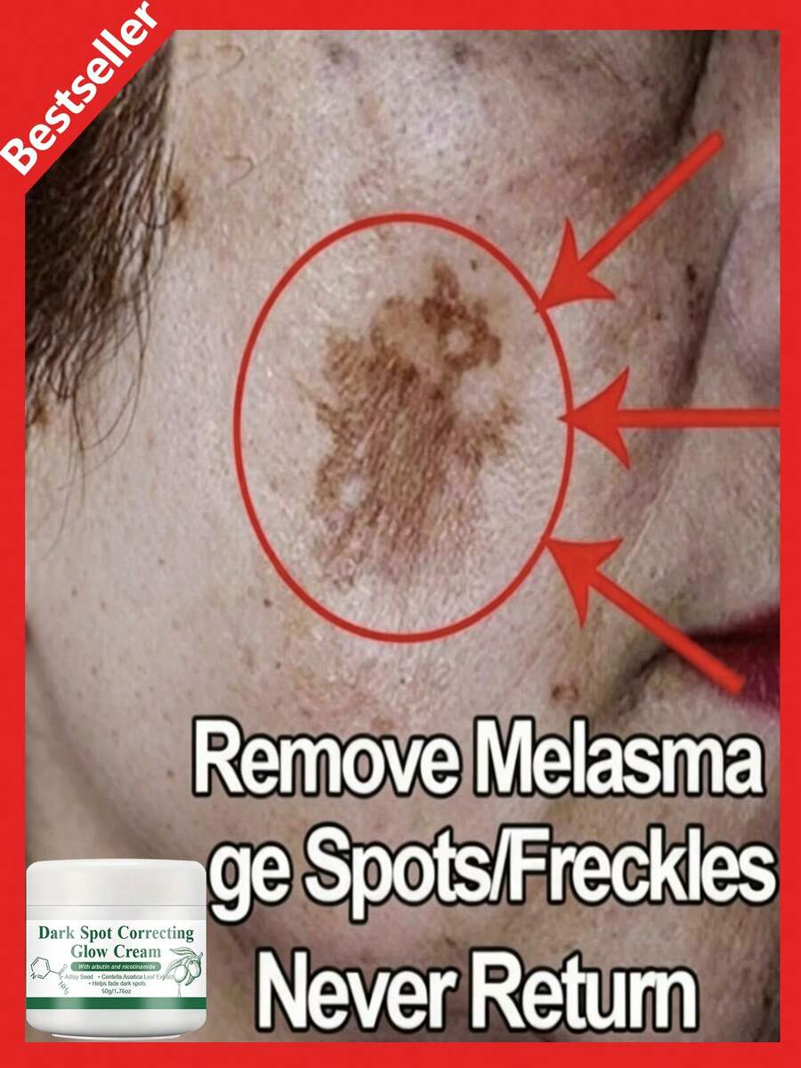 Krim Pemutih Efektif, Mencerahkan Kulit, Memudarkan Noda, Menghilangkan Bintik-bintik dan Pigmentasi, Memperbaiki Kulit Kusam - 1 buah - View 1