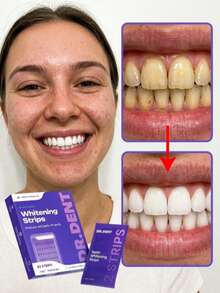 Purple Teeth Whitening Strips, 14Pcs Professional Dental Stain Remover, Peroxide-Free Sensitive Teeth Whitener, Rapid Whitening Patches For Coffee/Tea Smokers, 30-Min Instant Result Daily Dental Care. - Dải - Xem 4