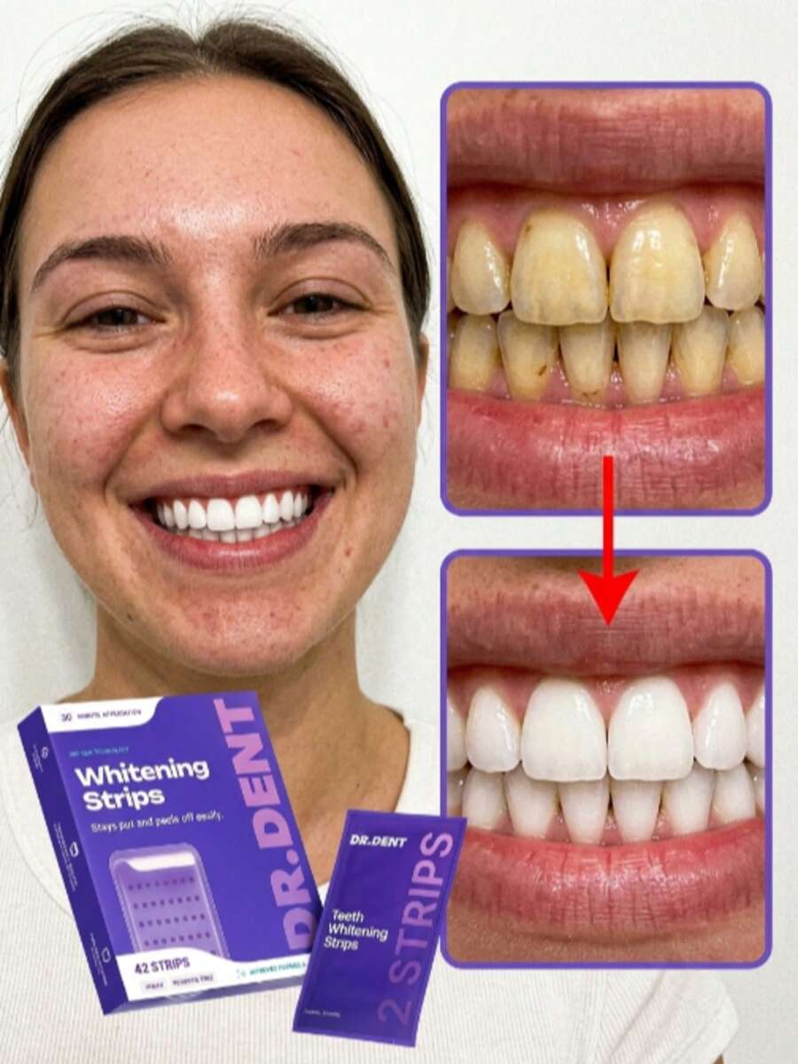 Purple Teeth Whitening Strips, 14Pcs Professional Dental Stain Remover, Peroxide-Free Sensitive Teeth Whitener, Rapid Whitening Patches For Coffee/Tea Smokers, 30-Min Instant Result Daily Dental Care. - 打條 - 查看 1