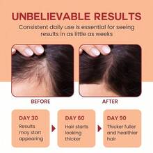 Lebanta Raw Batana Oil - 100% Pure, Organic 4oz Batana From Honduras For Thick And Strong Natural Hair - Dr. Sebi Unrefined Cold Pressed Cosmetic Scalp Mask Gifts For Women (1 Pack) - default - 查看 3