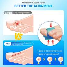 TASZOOS Hammer Toe Straightener - (6Pcs, Blue) - Gel Toe Splint Relief For Bunion, Crooked, Hammer, Broke Support - 3 Different Sizes (S_M_L) - trắng - Xem 2