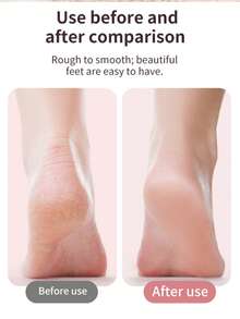 Rechargeable Electric Foot File, 3-Speed Adjustable Foot Callus Remover, Detachable & Washable Grinding Head For Calluses, Cracked Heels, Portable Home Foot Care Gift - View 10