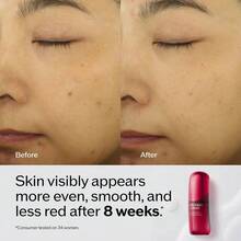 Shiseido 终极免疫力注入精华液 - 120毫升 - 查看 8