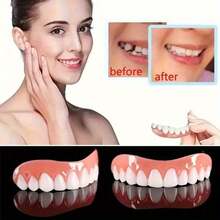 Natural Silicone Cosmetic Dental Veneer Set Perfect Gum Fit With Essential Tools Affordable Beauty Restoration Easily Refresh Your Smile - 1 Set - View 1