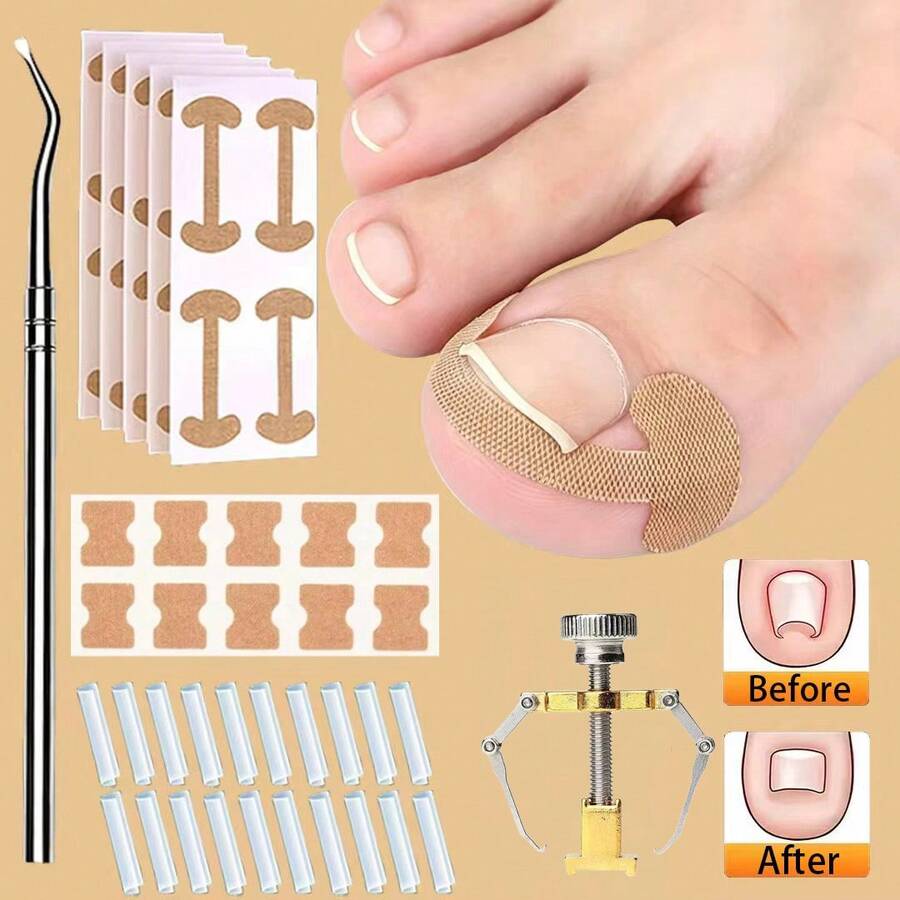 28pcs/Set Ingrown Toenail Filler Pads Nail Correction Stickers Ingrown Nail Tools Nail Cleaning Tools Suitable For All Types Of Foot Care - Multicolor - View 1