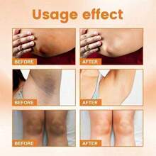3pcs Vitamin C Skin Whitening Cream,Skin Bleaching Cream,Dark Spot Remover For Face,Skin Lightening Cream For Intimate Areas,Neck,Armpit,Elbow, Inner Thigh And Knees,Improve Underarm Dullness Odor - 多色的 - 查看 5