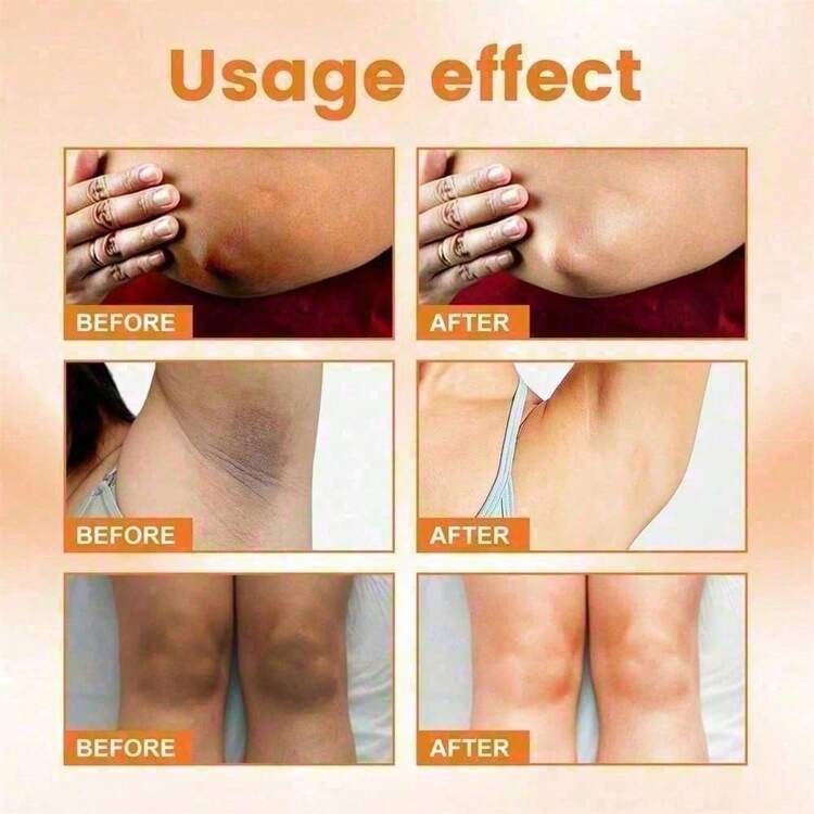 3pcs Vitamin C Skin Whitening Cream,Skin Bleaching Cream,Dark Spot Remover For Face,Skin Lightening Cream For Intimate Areas,Neck,Armpit,Elbow, Inner Thigh And Knees,Improve Underarm Dullness Odor - 多色的 - 查看 5