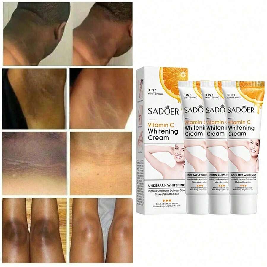 3pcs Vitamin C Skin Whitening Cream,Skin Bleaching Cream,Dark Spot Remover For Face,Skin Lightening Cream For Intimate Areas,Neck,Armpit,Elbow, Inner Thigh And Knees,Improve Underarm Dullness Odor - 多色的 - 查看 1