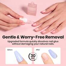 Beetles 20g&10ml Gel Nail Glue & Remover Kit, No Wipe Hands-Free Nail Glue For Tipex Soft Gel Nail Tips & Clear Press On Nails, 10ml Nail Remover With Nail Tools, Gentle Formula, Gift For Women - 20g&10ml Gel Nail Glue & Remover Kit - 查看 7