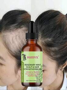 100% Pure Natural Rosemary Hair Oil - Moisturizing And Smoothing, Suitable For All Hair Types, Especially For Dry Hair And Scalp Care - 1.01 Oz/30 Ml, Natural Hair Care | Smoothing Hair Care | Moisturizing Benefits, Hair Care Products. - 30毫升 - 查看 2