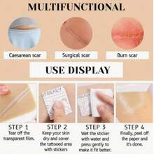 Waterproof Tattoo Cover Stickers, 5pcs/7pcs Scar Cover Tape, Tattoo Cover Patch, Natural Skin Tone Sticker, Burn Scar Cover, Surgical Scar Cover, Waterproof Body Patch, Temporary Concealer Sticker, Body Makeup Cover Patch - View 2