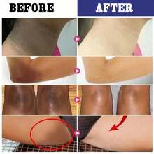 3pcs Vitamin C Skin Whitening Cream,Skin Bleaching Cream,Dark Spot Remover For Face,Skin Lightening Cream For Intimate Areas,Neck,Armpit,Elbow, Inner Thigh And Knees,Improve Underarm Dullness Odor - 多色的 - 查看 3