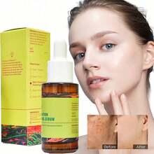 Molecules Discoloration Correcting Serum - Tranexamic Acid And Niacinamide Serum To Target Dark Spots And Hyperpigmentation - Skin Care For Face - Hyaluronic Acid - 查看 9