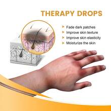 Suero iluminador rápido para nudillos oscuros, codos, suero iluminador para nudillos de mano, rodilla, piel negra, aclara rápidamente la esencia eliminadora de manchas - 1 - Ver 3