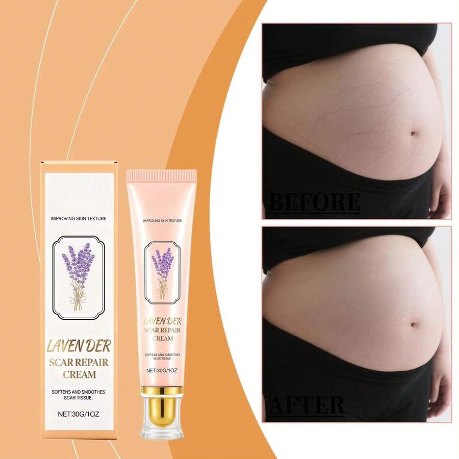 Stretch Mark Creams & Oils - 1 - View 1