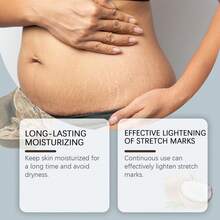 Stretch Mark Creams & Oils - 1 - View 4