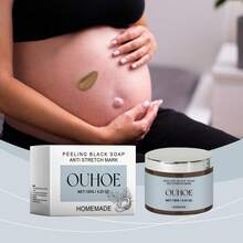 Stretch Mark Creams & Oils - 1 - View 1