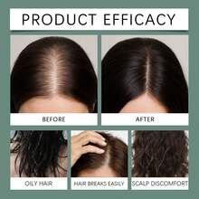 Scalp Treatment - 1 - View 7