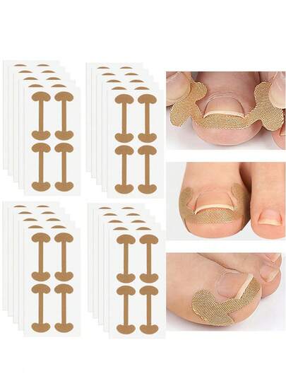 200pcs/80pcs/20pcs Painless Ingrown Toenail Correction Stickers, Specialized Filler Pads, Easy-To-Use Nail Correction Tool, Isolates And Corrects Ingrown Nails, Soothes And Repairs, Unisex, Daily Portable Soft Gel, Natural Foot Care, Improves Ingrown Nail Inflammation, Essential Pedicure Item For Clean Freaks