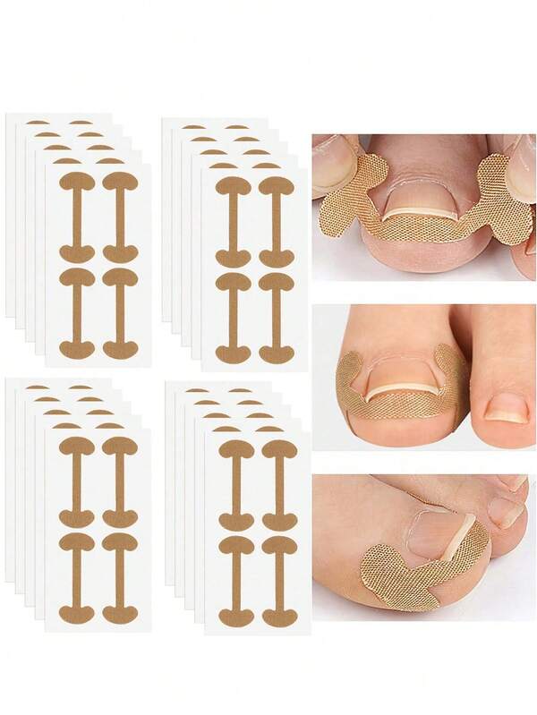 200pcs/80pcs/20pcs Painless Ingrown Toenail Correction Stickers, Specialized Filler Pads, Easy-To-Use Nail Correction Tool, Isolates And Corrects Ingrown Nails, Soothes And Repairs, Unisex, Daily Portable Soft Gel, Natural Foot Care, Improves Ingrown Nail Inflammation, Essential Pedicure Item For Clean Freaks