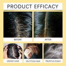 Champú nutritivo para el cabello de jazmín, reparación dañada, mejora el cuero cabelludo grueso, tratamiento irritante, Control de caspa, champú para el crecimiento del cabello - 1 - Ver 7
