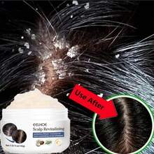 100g,Scalp Scrub, Deeply Cleanses Scalp Keratin, Improves Oil Secretion, Repairs Split Hair Frizz, Refreshing Hair Care, Promotes Hair Health, Increases Hair Luster, And Softens Hair Care Scrub - tẩy tế bào chết da đầu - Xem 3