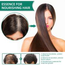 Líquido de Cuidado Capilar Herbal con Hoja de Biota Oriental, Nutre el cuero cabelludo, fortalece las raíces, reduce la caída y revitaliza el cabello débil - 1 - Ver 10