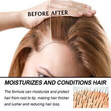 Crema Cuidativa Intensiva para Cuero Cabelludo, nutrición profunda para fortalecer el cabello, efecto fijador duradero y cuidado completo diario - 1 - Ver 4