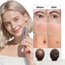 Dr.Pen A10 Microneedle Roller - Pena Microneedle Kelas Profesional, Cocok untuk Tubuh dan Wajah, Dapat Diisi Ulang USB - Set Alat Perawatan Kulit, Hadiah Sempurna untuk Ibu dan Wanita - Coklat - View 6