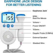Baby Heartbeat Monitor Pregnancy, Fetal Doppler With Gel, High Sensitivity, Large Screen Display, Home Use Fetal Monitor, Gift For New Moms - màu xanh lá - Xem 2